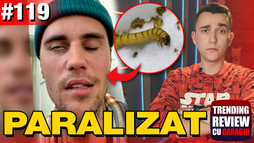 Motivul paraliziei lui Justin Bieber